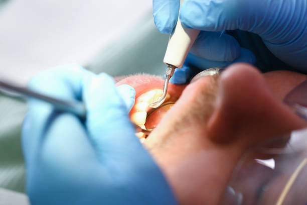 Best Cosmetic Emergency Dentistry in Bald Kno, AR